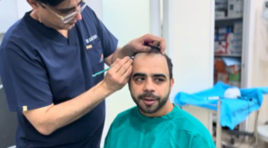 hair transplant result at AK Clinics